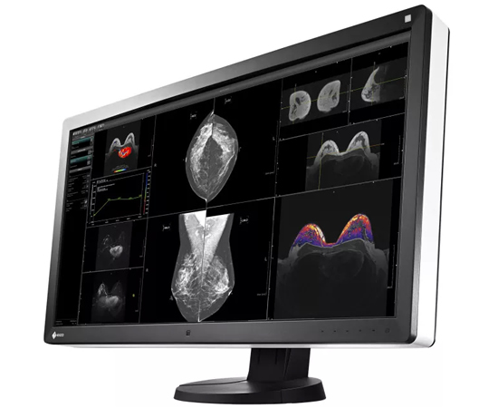 EIZO RadiForce RX850 02