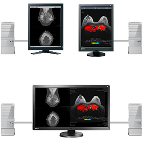 EIZO RadiForce RX850 07